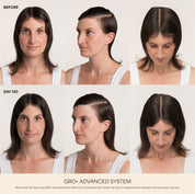 GRO+ Advanced — Sérum Croissance & Densité