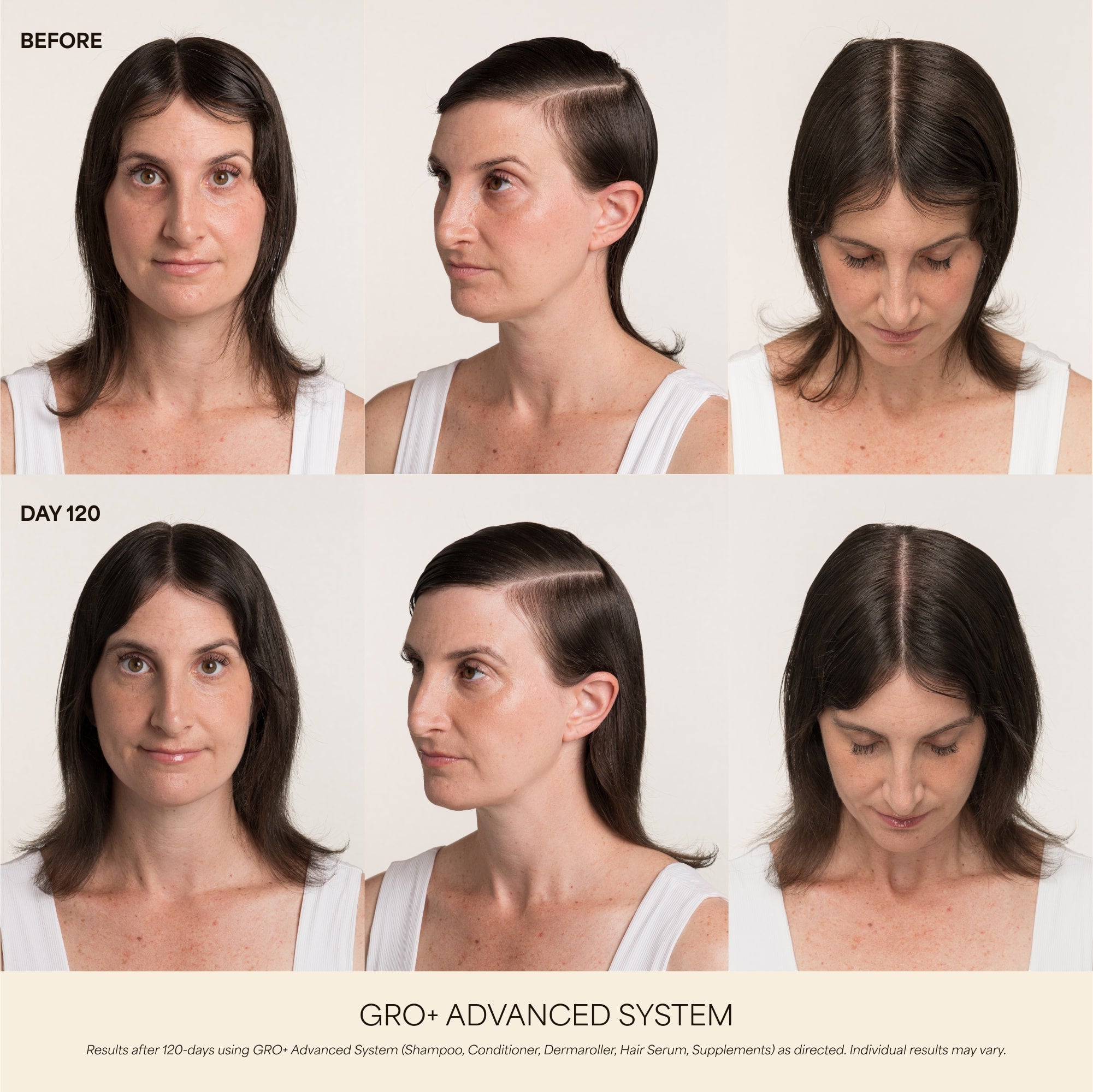 GRO+ Advanced — Sérum Croissance & Densité