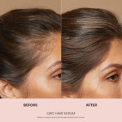 Sérum GRO pour la croissance des cheveux