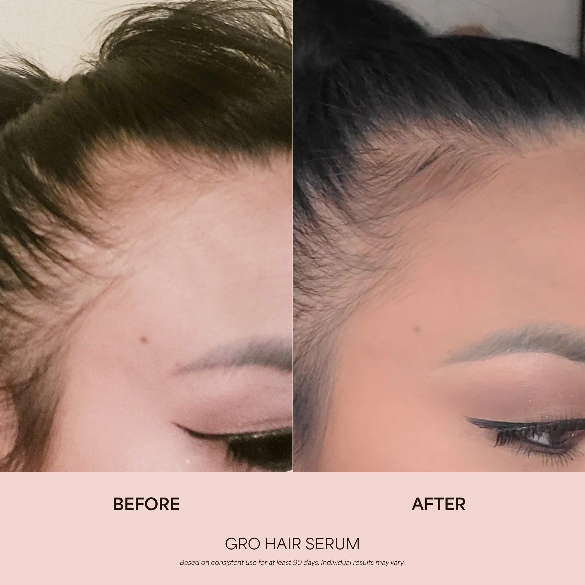 Gummies Biotine GRO pour la santé des cheveux