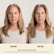 Compléments GRO+ Avancés — Croissance et Densité Capillaire