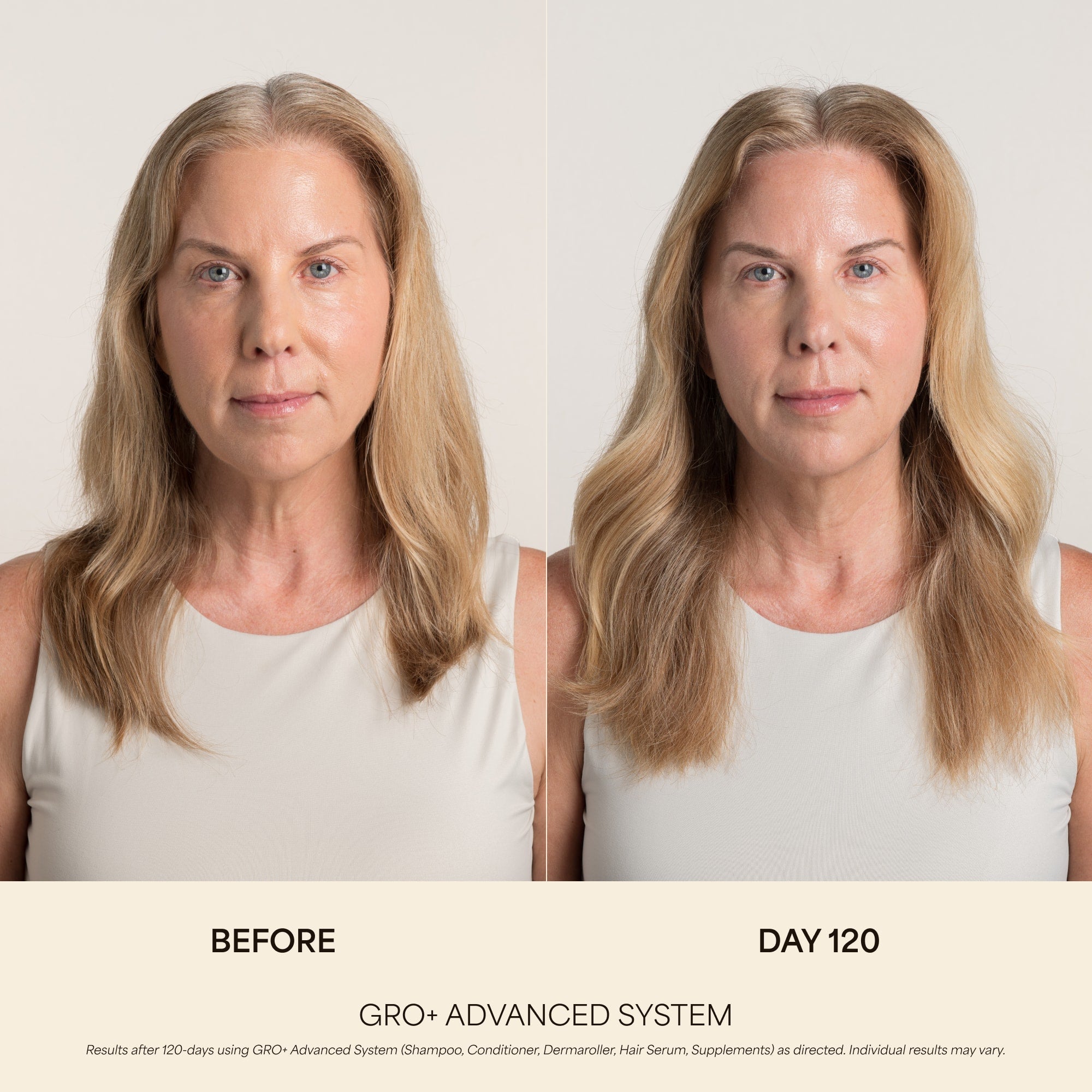 Compléments GRO+ Avancés — Croissance et Densité Capillaire